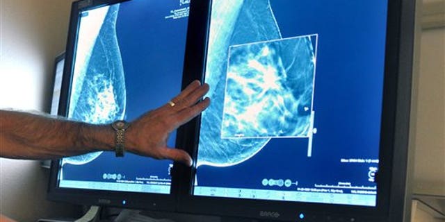 FILE - In this file photo, a radiologist compares an image from earlier, 2-D technology mammogram to the new 3-D Digital Breast Tomosynthesis mammography.