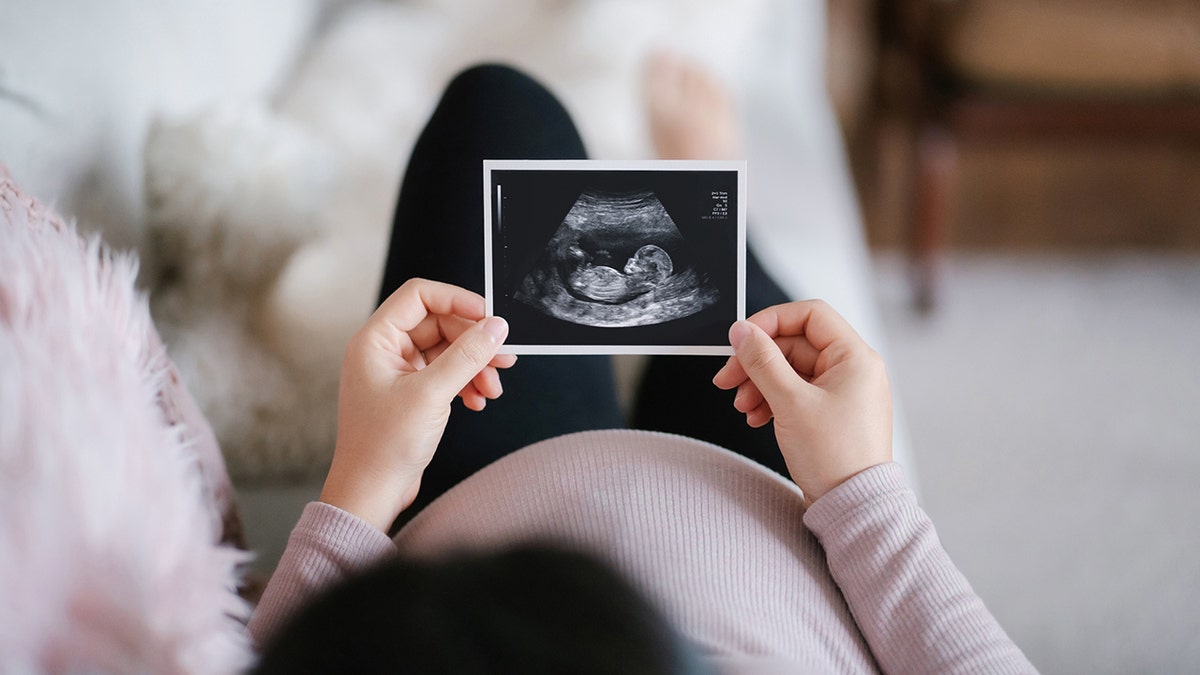 woman looking at ultrasound scan