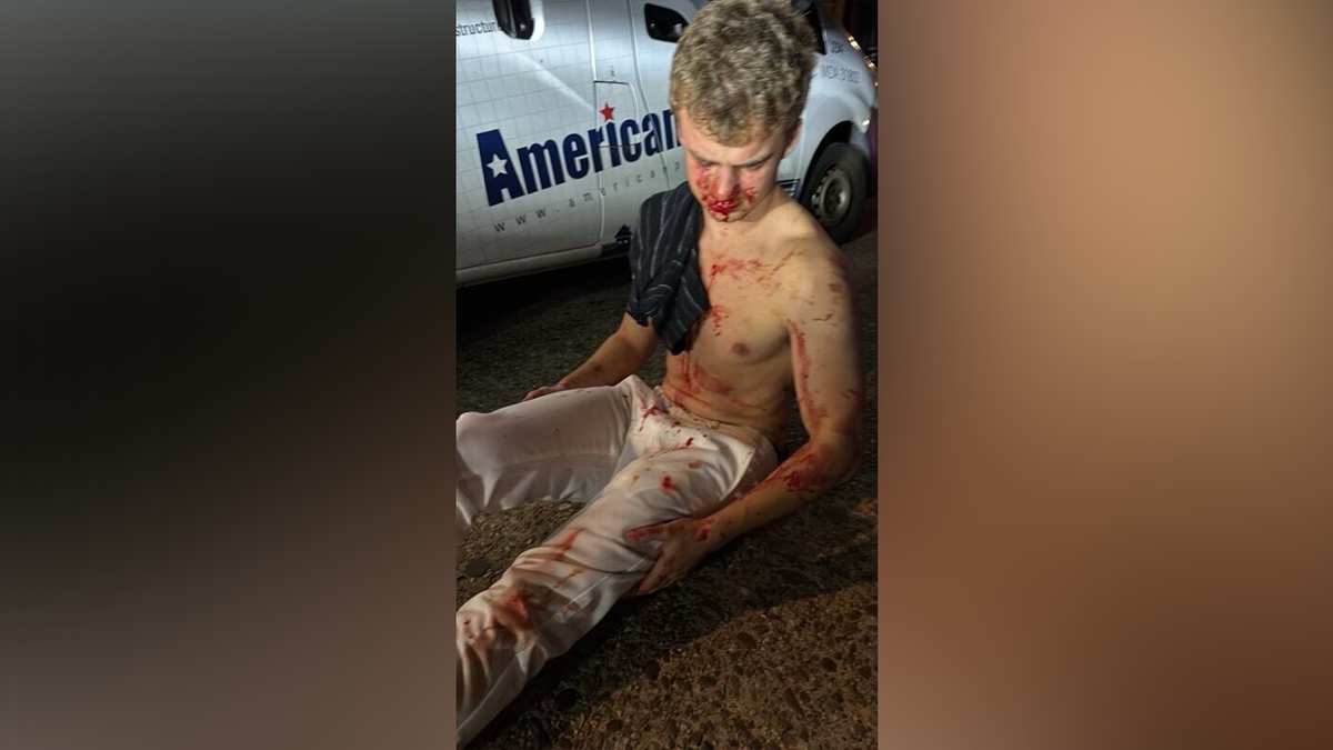 former DOGE employee beaten up