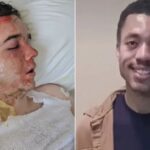 Young McDonald's Worker in ICU After Co-Worker Doused Him in Boiling Oil, According to Horrified Mom